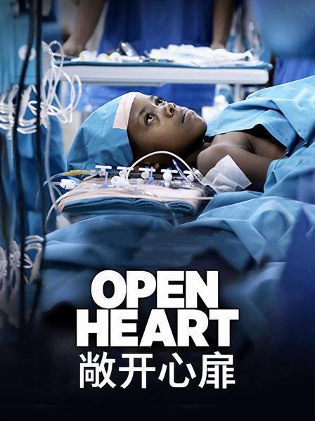 非洲心脏病孩子得到有效的免费治疗